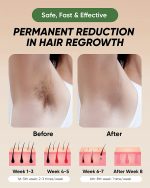 XSOUL At-Home IPL Hair Removal for Women and Men Permanent Hair Removal 999,999 Flashes Painless Hair Remover on Armpits Back Legs Arms Face Bikini Line, Corded - Image 5